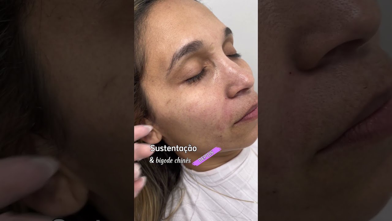 Sustenta&ccedil;&atilde;o e adeus ao bigode chin&ecirc;s! 🙌✨: Revelando uma pele mais firme e jovem a cada dia.