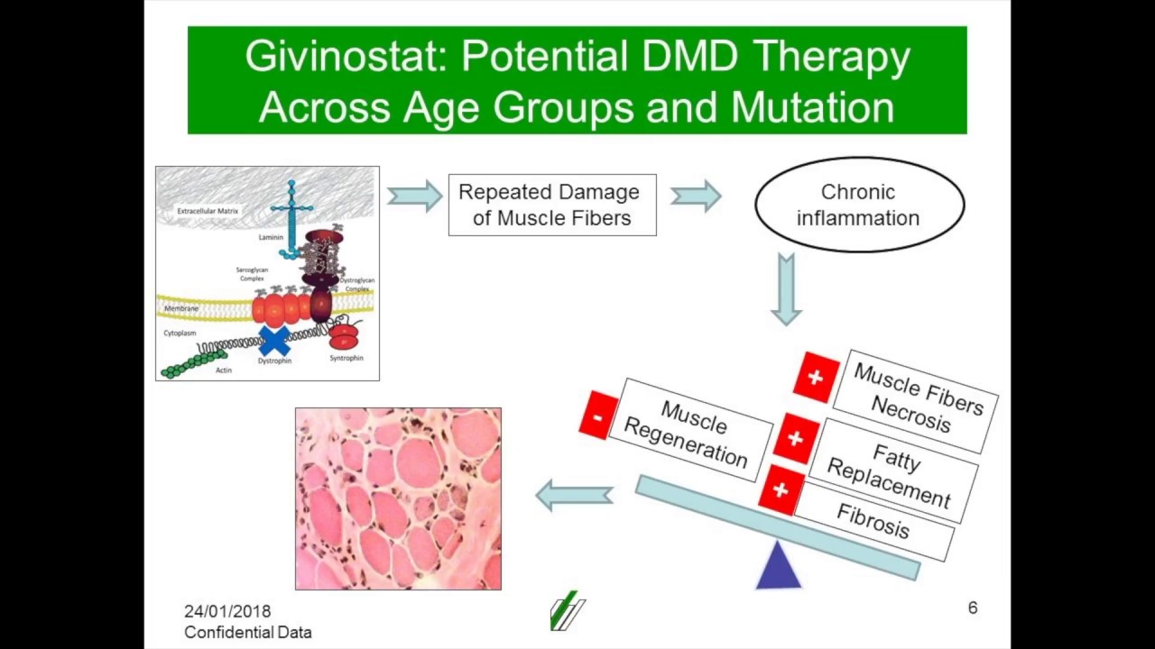 [Webinar] Italfarmaco Provides Givinostat Update - January 2018