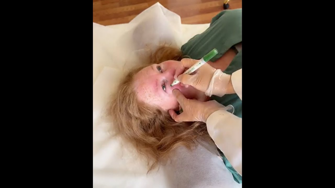 Teach the acupuncture points for Cataracts & Eye Issues