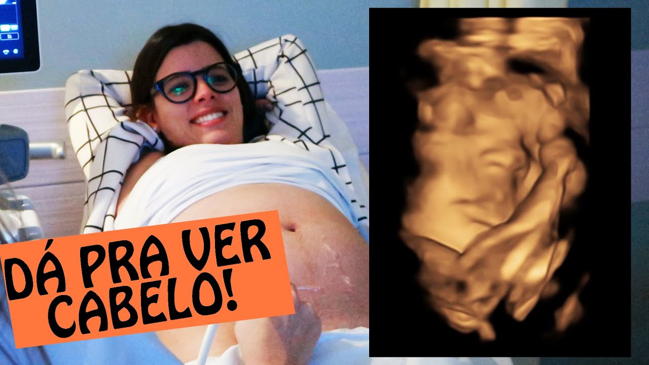 ÚLTIMO ULTRASSOM ANTES DO PARTO - #BabyTPM | TPM por Ju Ferraz