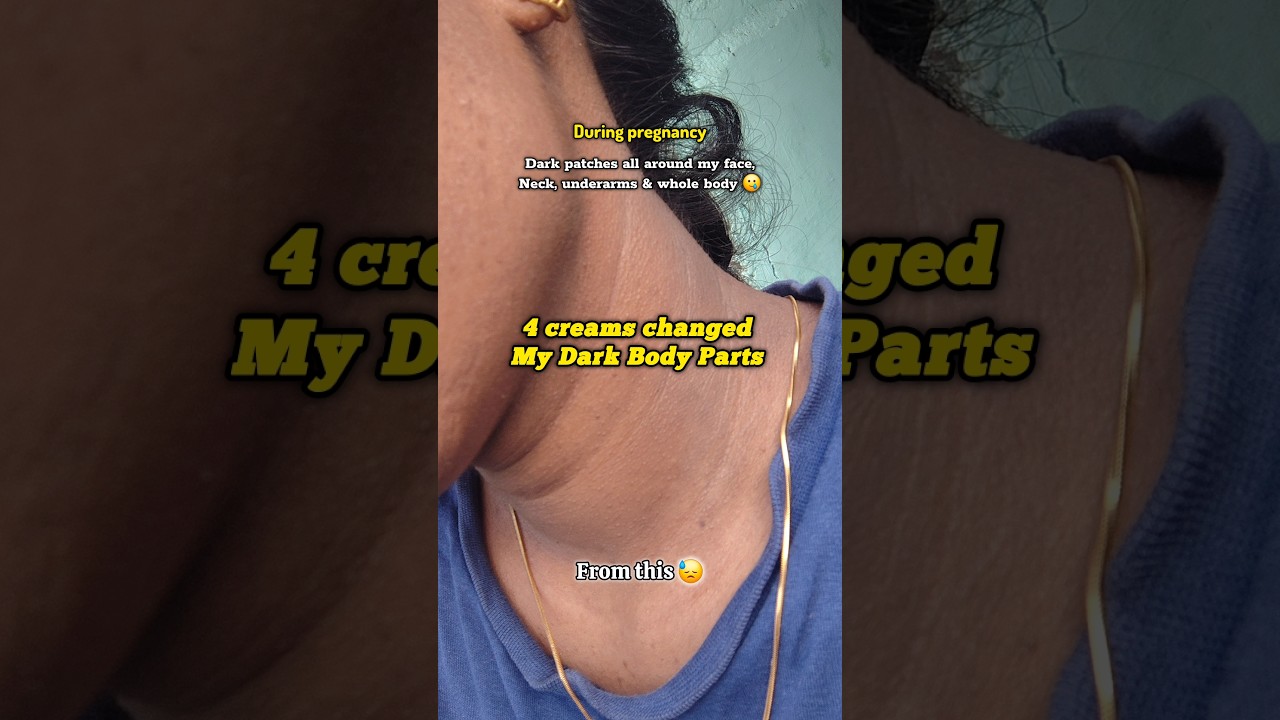 My body brightening skincare routine for hyperpigmentation! 🤯🚨✨️ #beforeandafter #skincare #shorts