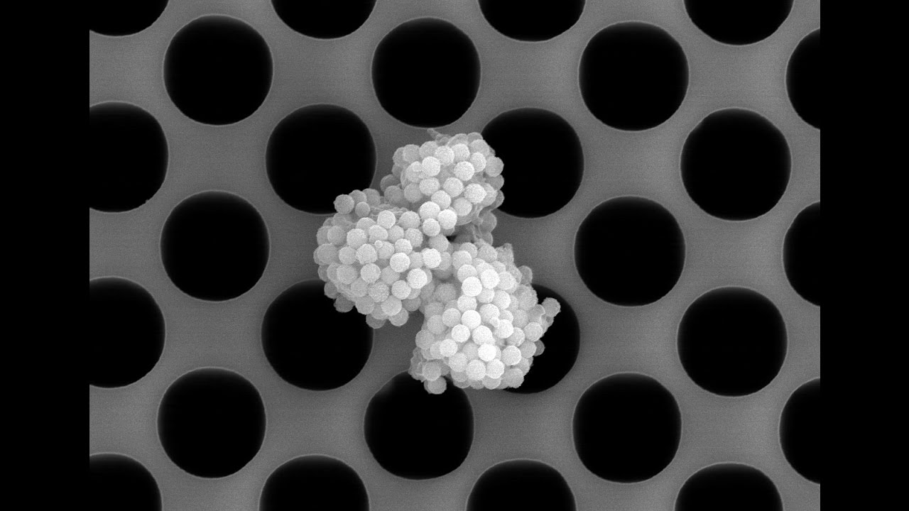 Lab on a Chip Transforms Cancer Diagnosis and Treatment