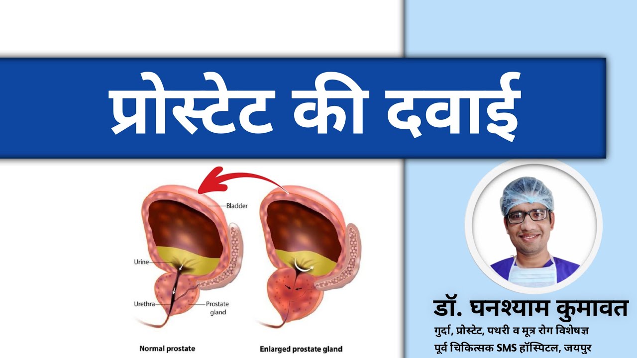 प्रोस्टेट की सबसे अच्छी दवाई ।💊 ✅️  👌Best Medicine For Enlarged Prostate👌 प्रोस्टेट की दवाई 💊👌