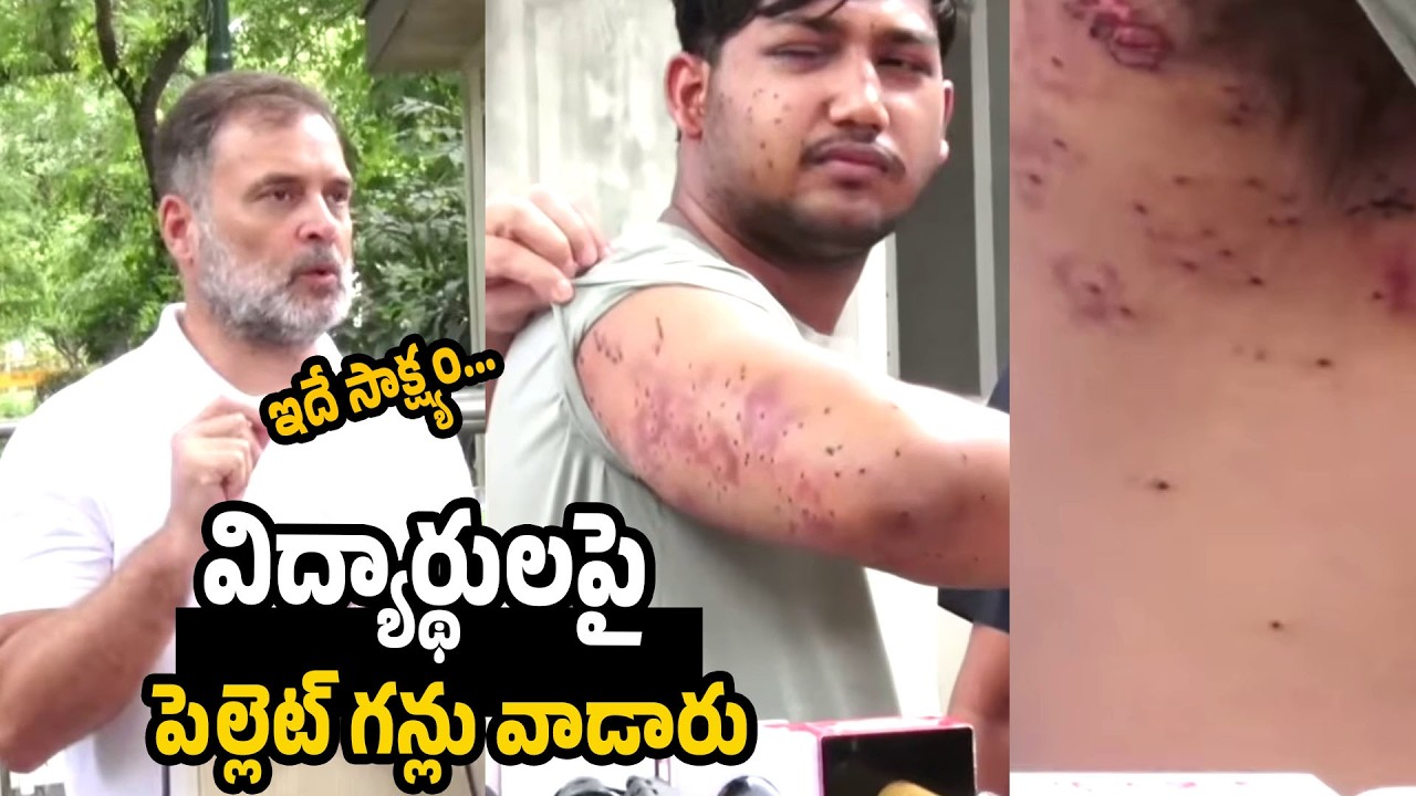 Rahul Gandhi Presents Injured Student, Raises Pellet Gun Allegations | Narendra Modi | Congress Part