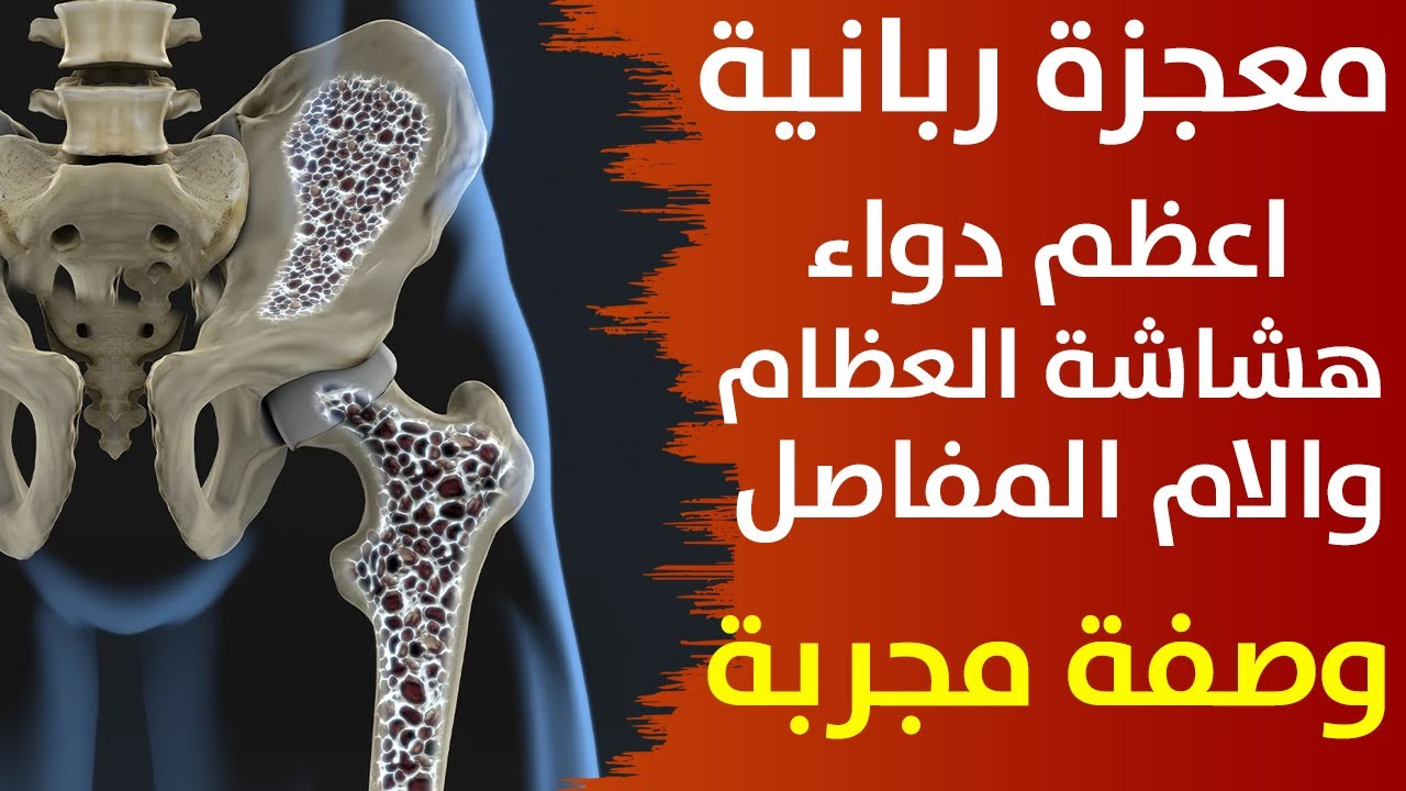 هذه الأغذية هي المكون الأساسي في علاج هشاشة العظام والتهاب المفاصل وستستغني عن الأدوية طيلة حياتك