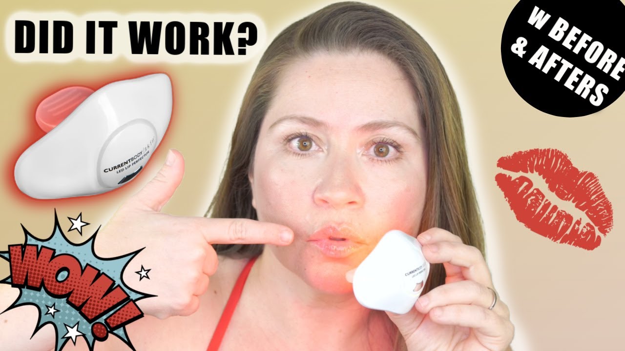 MY 8 WEEKS RESULTS WITH CURRENTBODY LED LIP PERFECTOR | W BEFORE & AFTERS