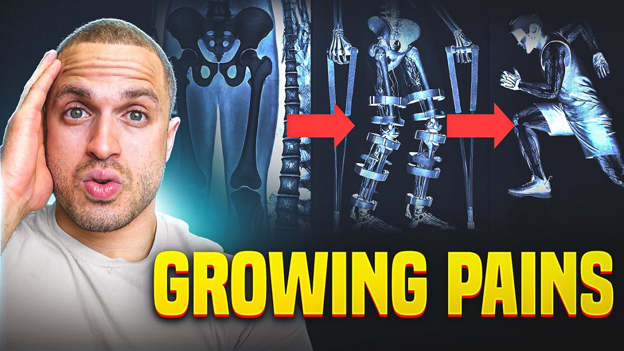 Limb Lengthening Pain Explained: Expect This in Recovery