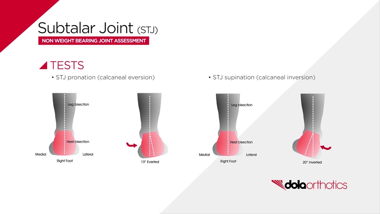 DOLA Orthotics:: NWB Joint Assessment - Subtalar Joint (STJ)