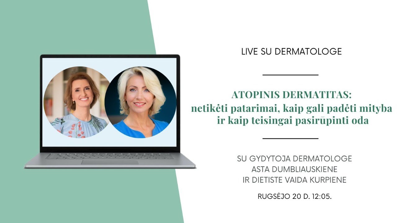 ATOPINIS DERMATITAS: netikėti patarimai, kaip gali padėti mityba ir kaip teisingai pasirūpinti oda