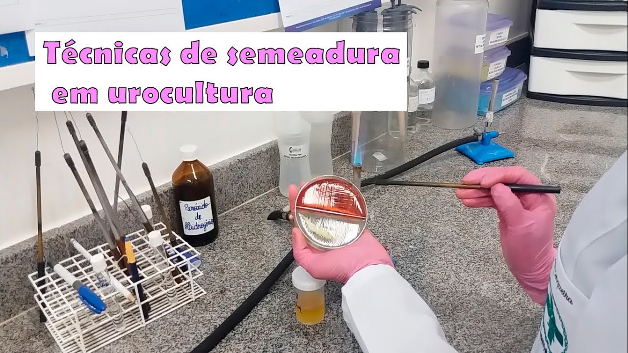 Técnicas de semeadura em urina
