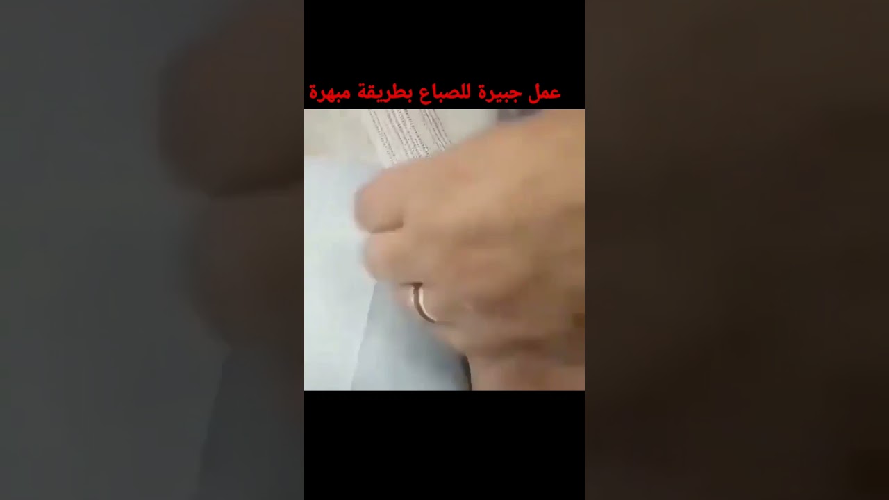 عمل جبيرة للصباع بطريقة جميلة ومبهرة #shorts