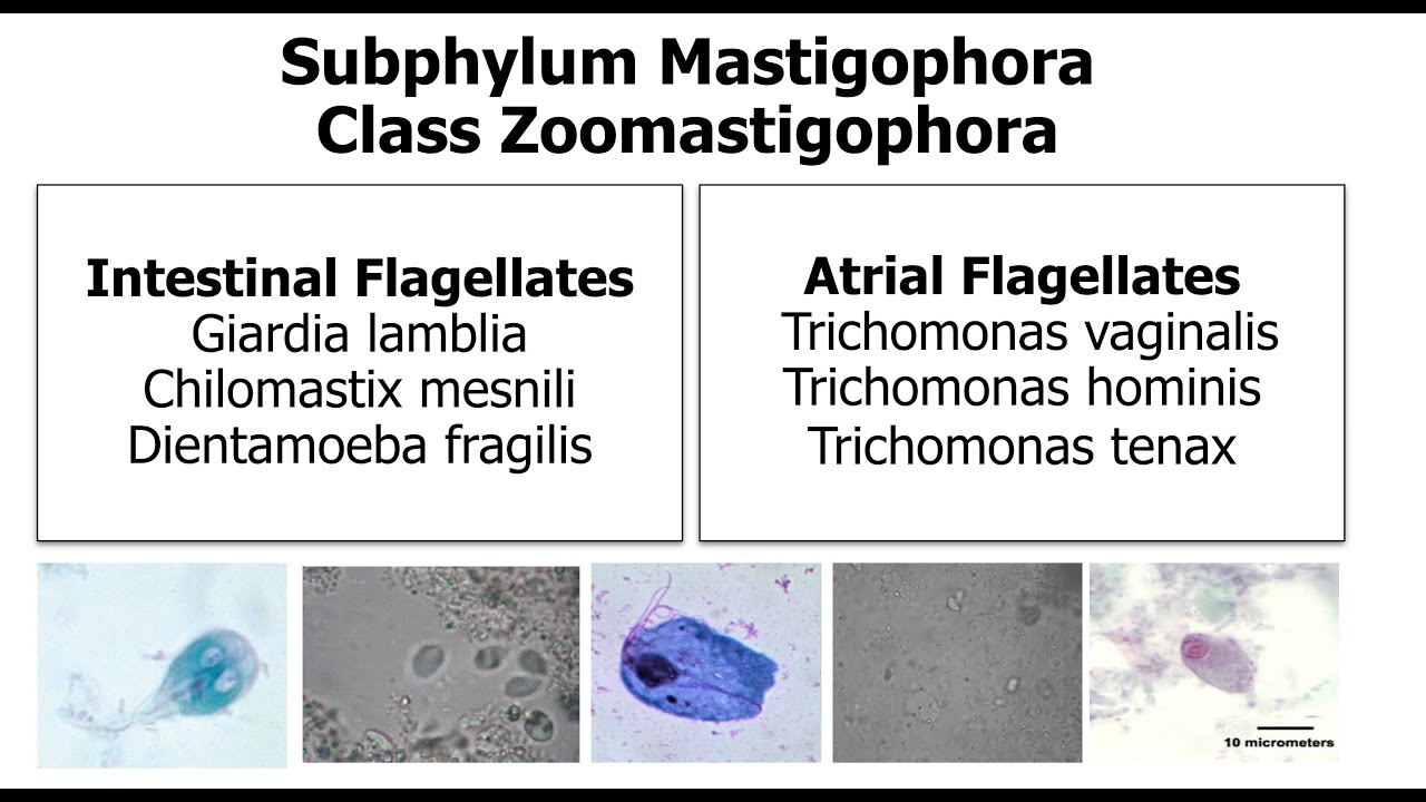 Intestinal, Extra-intestinal & Atrial Flagellates
