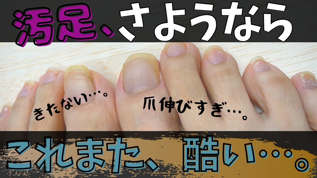 自宅で簡単！足のネイルケアを家にあるものと１００均アイテムでやってみた。