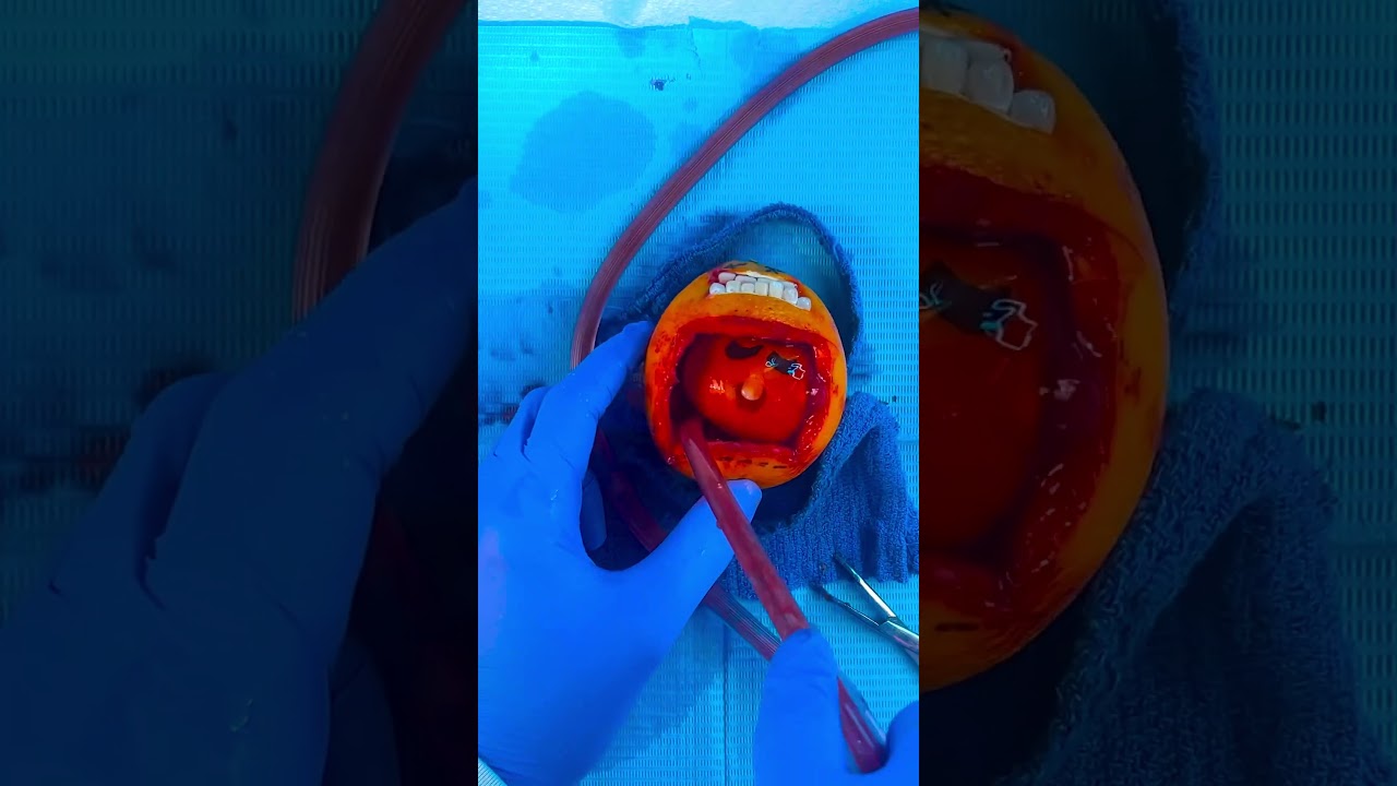 Emergency #FruitSurgery! Orange attacked during C-Section 😓🪦💔 #FoodSurgery #DiscountDentist #ASMR