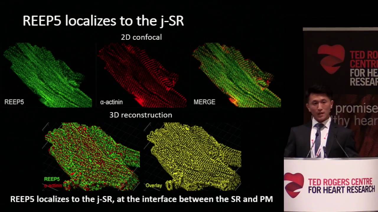Reep5 is essential formation and function of endoplasmic reticulum in heart