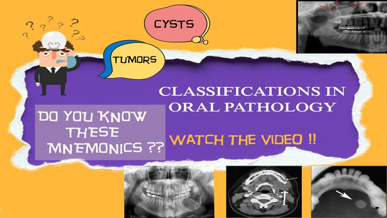 Oral pathology classifications made easy with mnemonics|3rd year BDS|Bibliodent