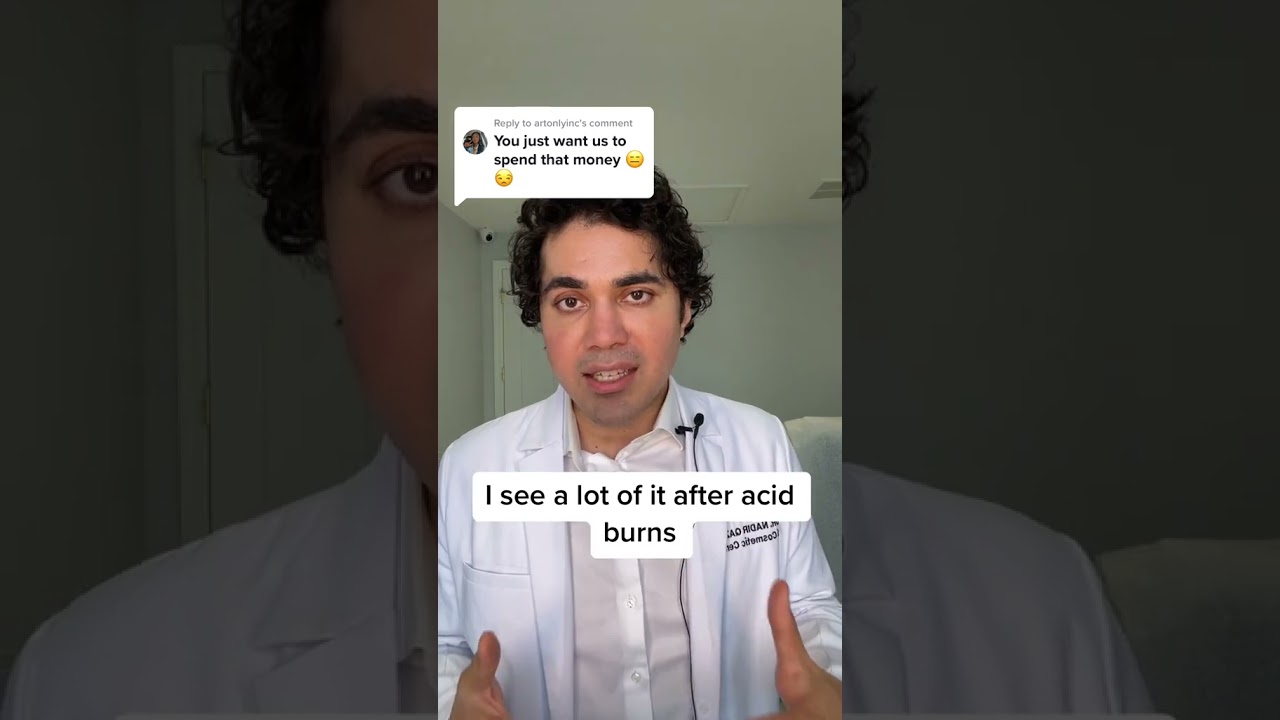Be CAREFUL of AT HOME Skincare Remedies 🤔 (Avoid CHEMICAL BURNS) #skincaretips #skincareproducts