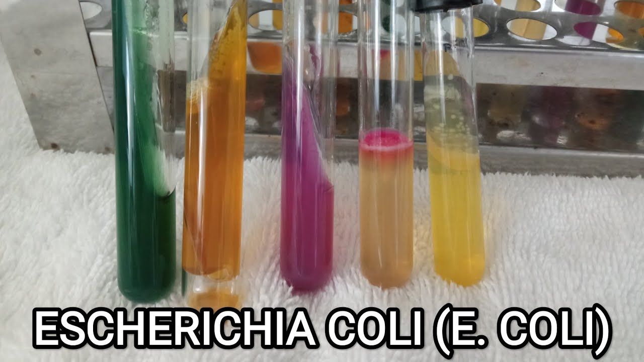 ¡Guía Práctica de Pruebas Bioquímicas para Principiantes!