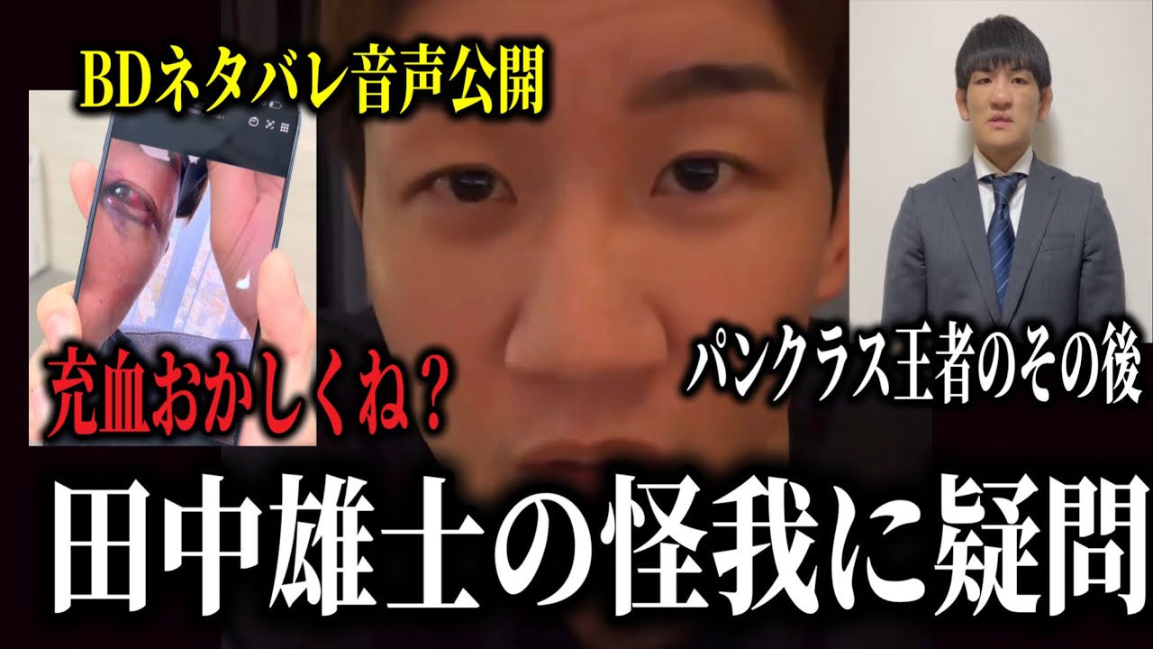 「ガチの怪我だと思います？」朝倉未来などから田中裕士の怪我へ疑惑が噴出、内藤裕のネタバレ音声が公開され内容がヤバすぎると話題、BD出演で王座剥奪となった濱田巧選手のその後、ほか…