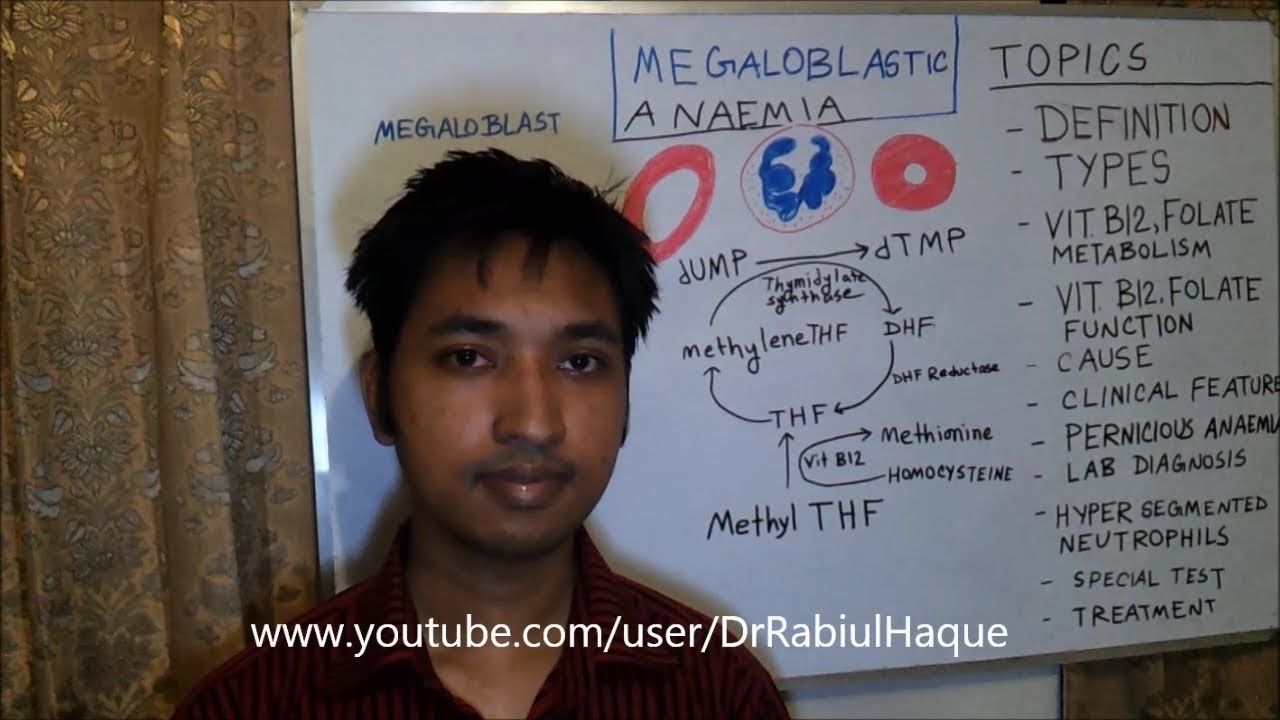Megaloblastic Anaemia: Vit B12 & Folate Deficiency Anaemia, Pernicious Anaemia (HD)