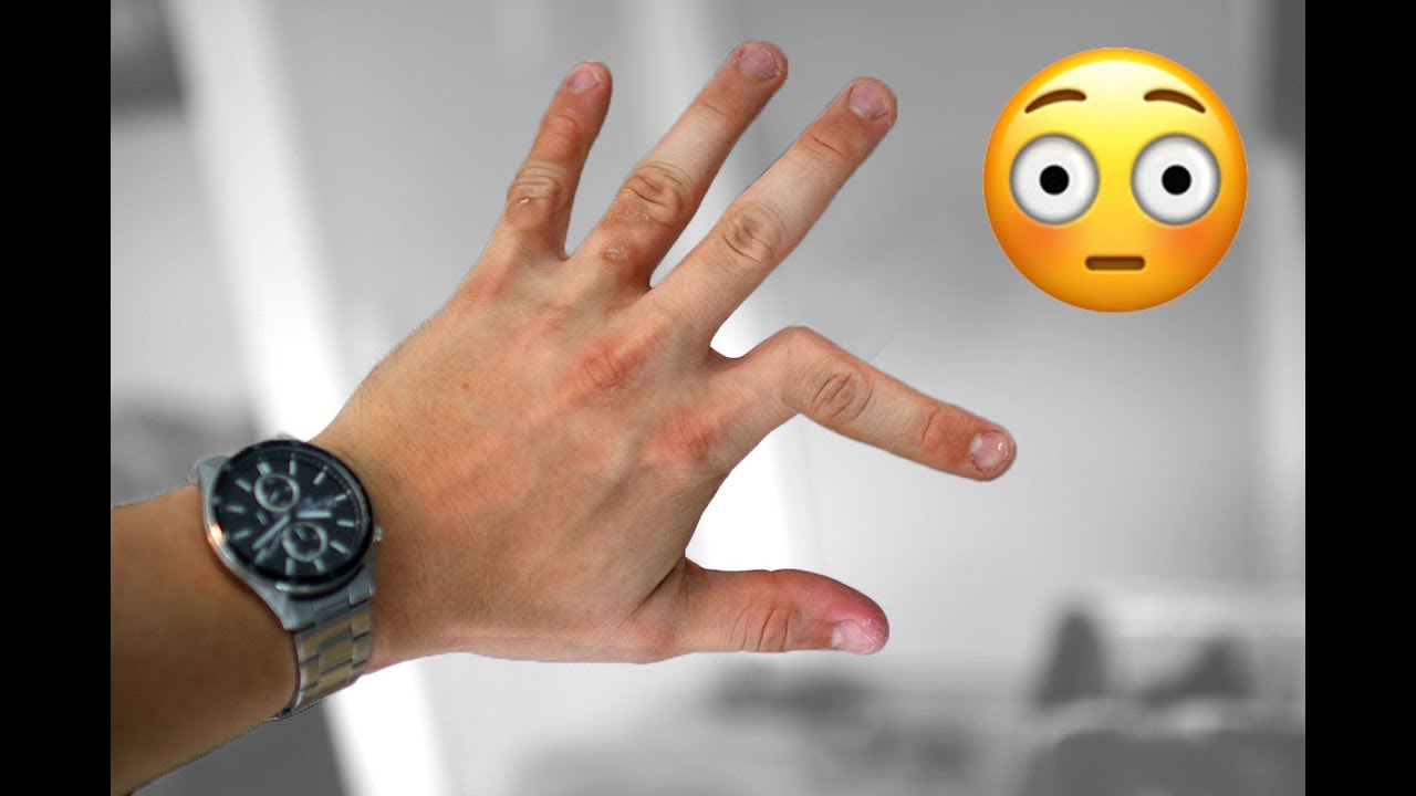 L&aelig;r at br&aelig;kke din finger! // L&aelig;r at trylle