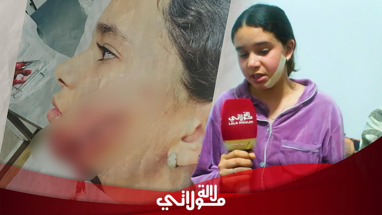 سيناريو 
