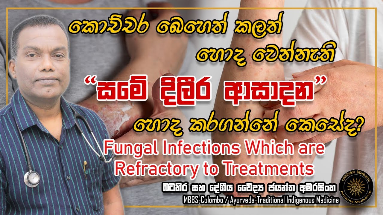 කොච්චර බෙහෙත් කලත් හොද වෙන්නැති සමේ දිලීර ආසාදන | Fungal Infections #fungaldisease #fungalinfections