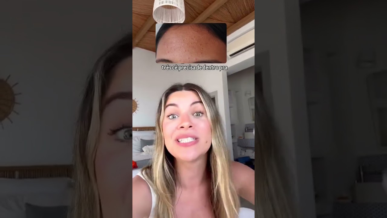 MELHORES TRATAMENTOS PARA ESPINHAS!