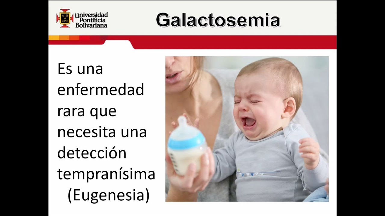 Lactantes Galactosémicos