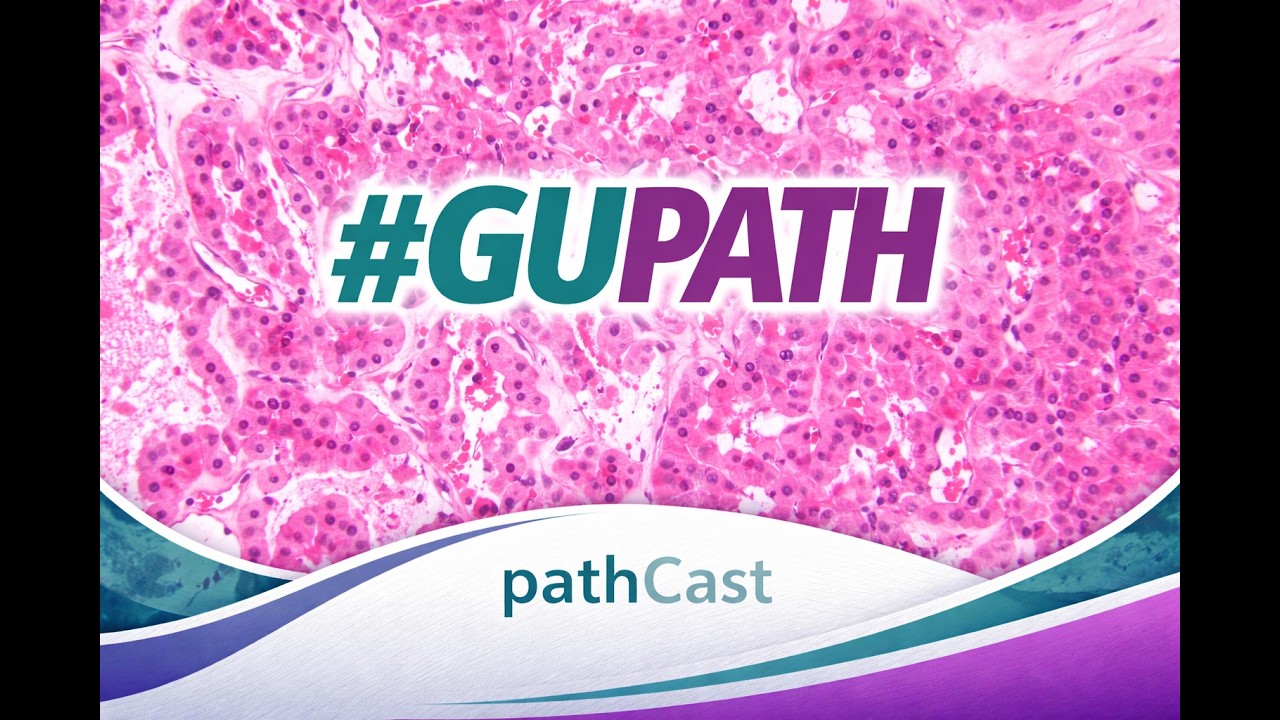 #GUPATH  GUPS and ISUP New Guidelines ForReporting of Intraductal Carcinoma of the Prostate
