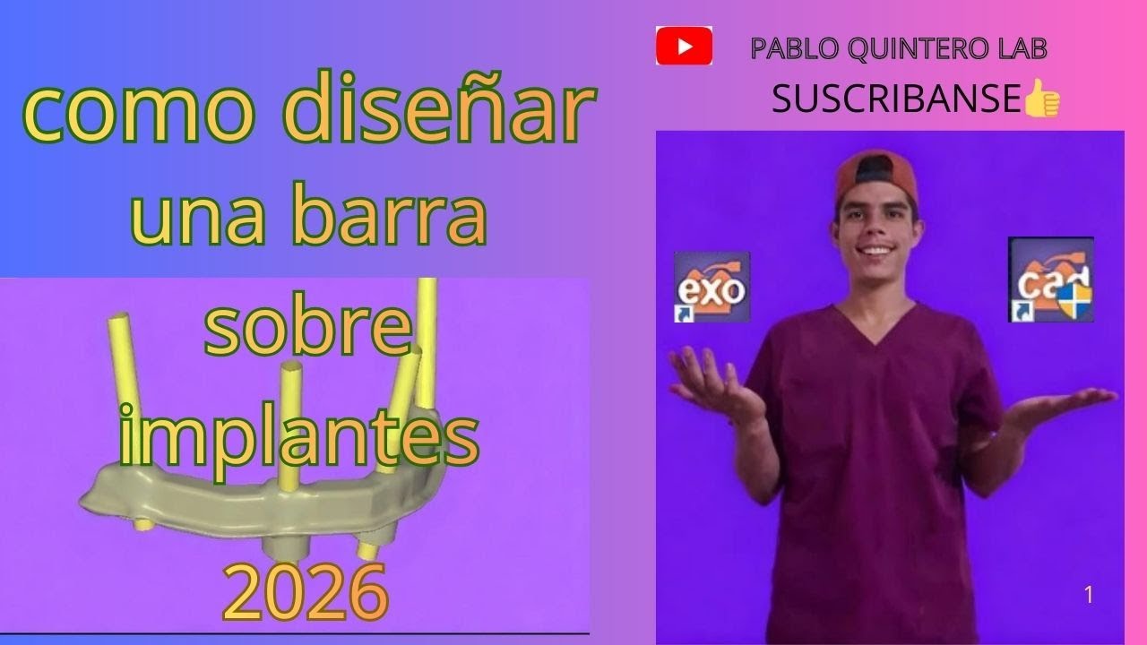 COMO DISEÑAMOS UNA BARRA SOBRE IMPLANTES EN EL 2026