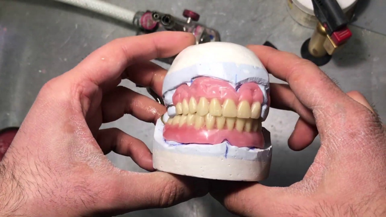 Постановка зубного протеза.(Этап 2)