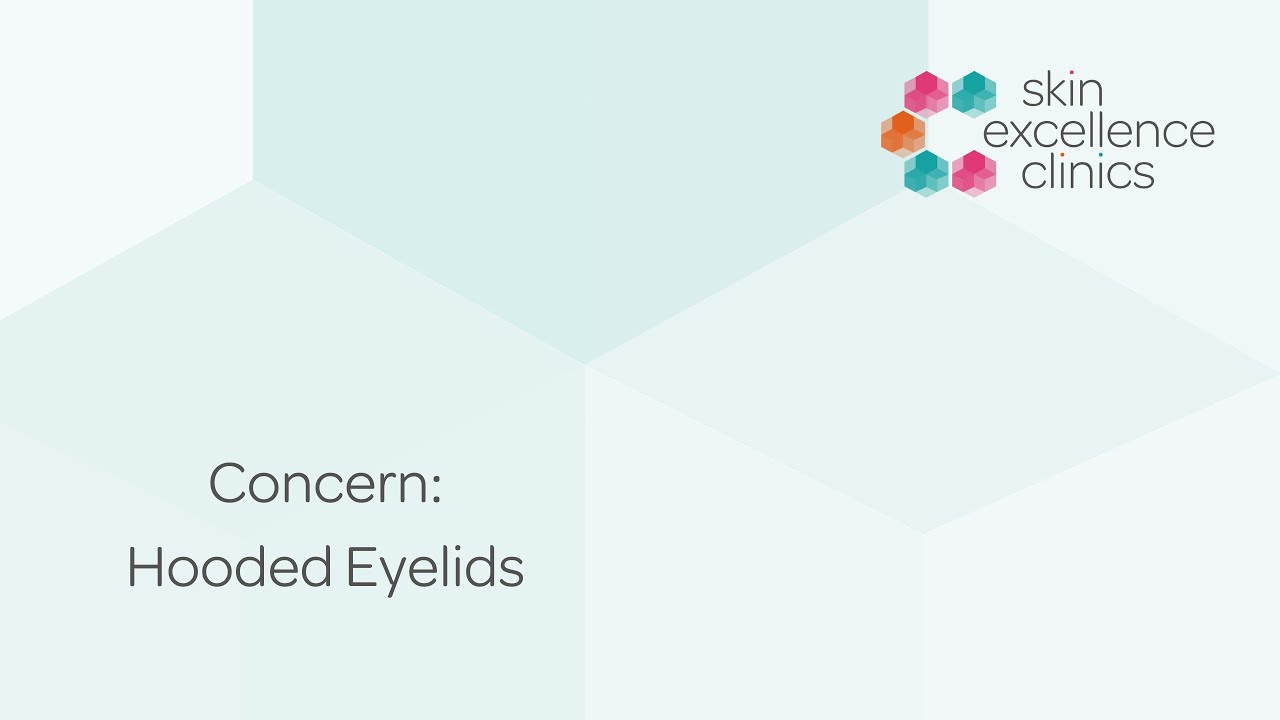 What is the best way to treat Hooded Eyelids?