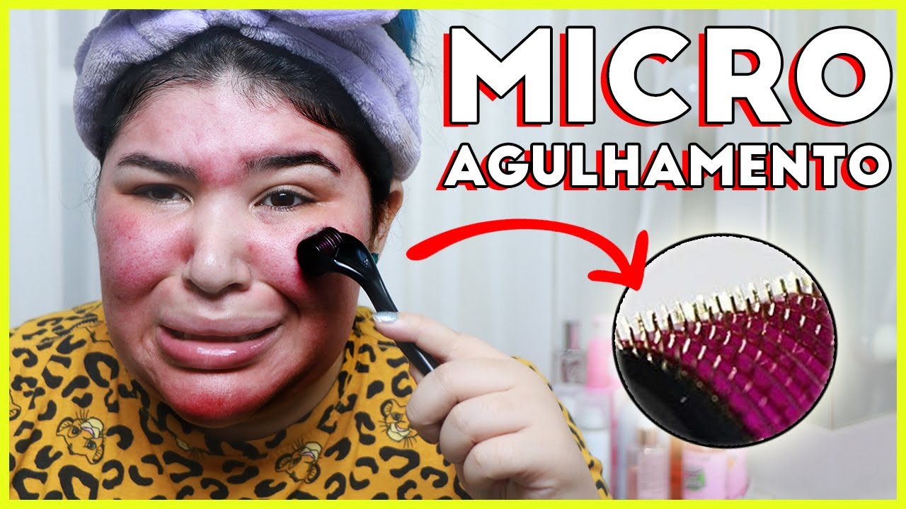🩸Microagulhamento facial como eu faço