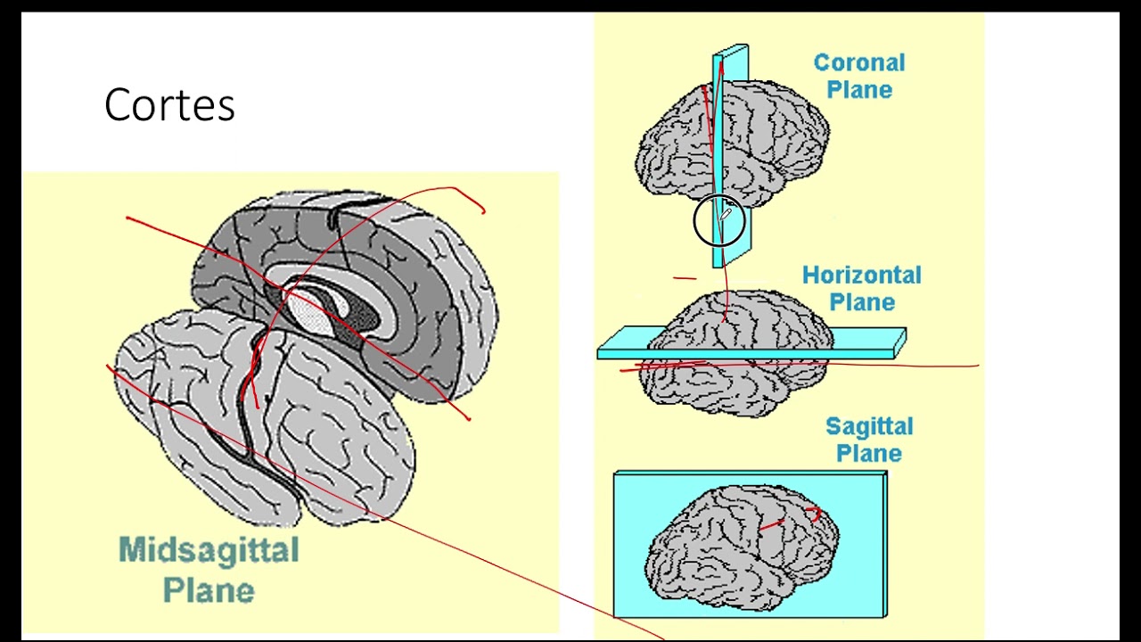 Comparación Corte Sagital vs Coronal vs Transversal