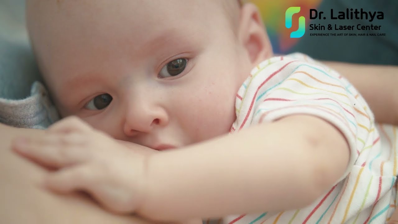 Breastfeeding Awareness Month | Cracked Nipples | Dr. Lalithya Dermatologist | Dr. Lalithya Derma
