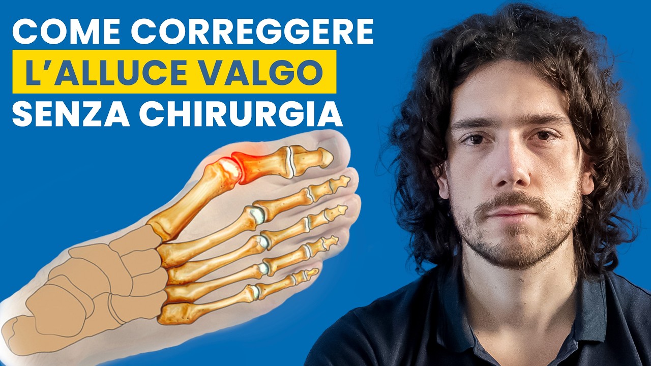 3 Esercizi per Correggere l'Alluce Valgo e Prevenirne il Ritorno (SENZA Chirurgia!)