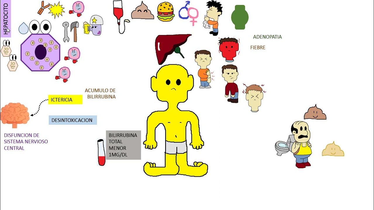 HEPATITIS AGUDA INFANTIL