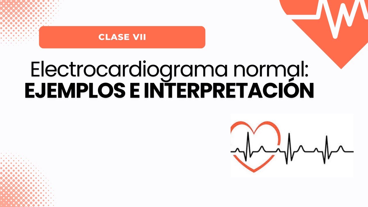 Electrocardiograma normal: ¡Aprende a interpretar EKGs en minutos!