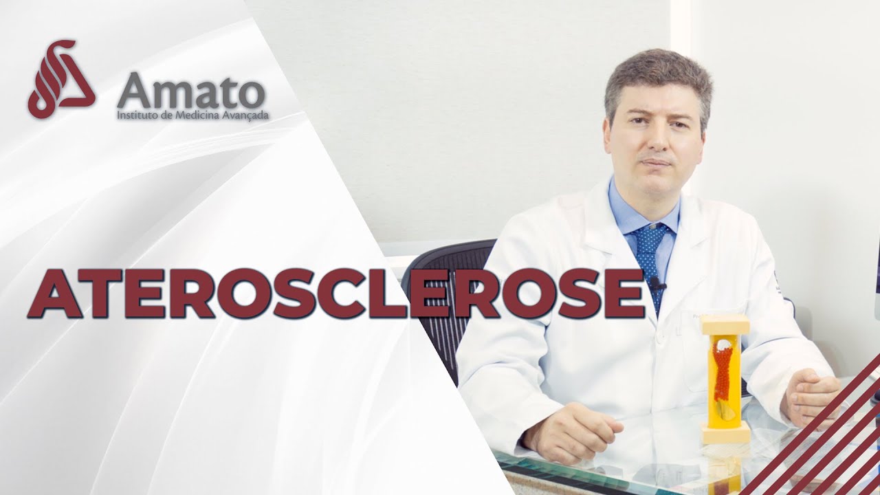 Aterosclerose, a doen&ccedil;a das art&eacute;rias