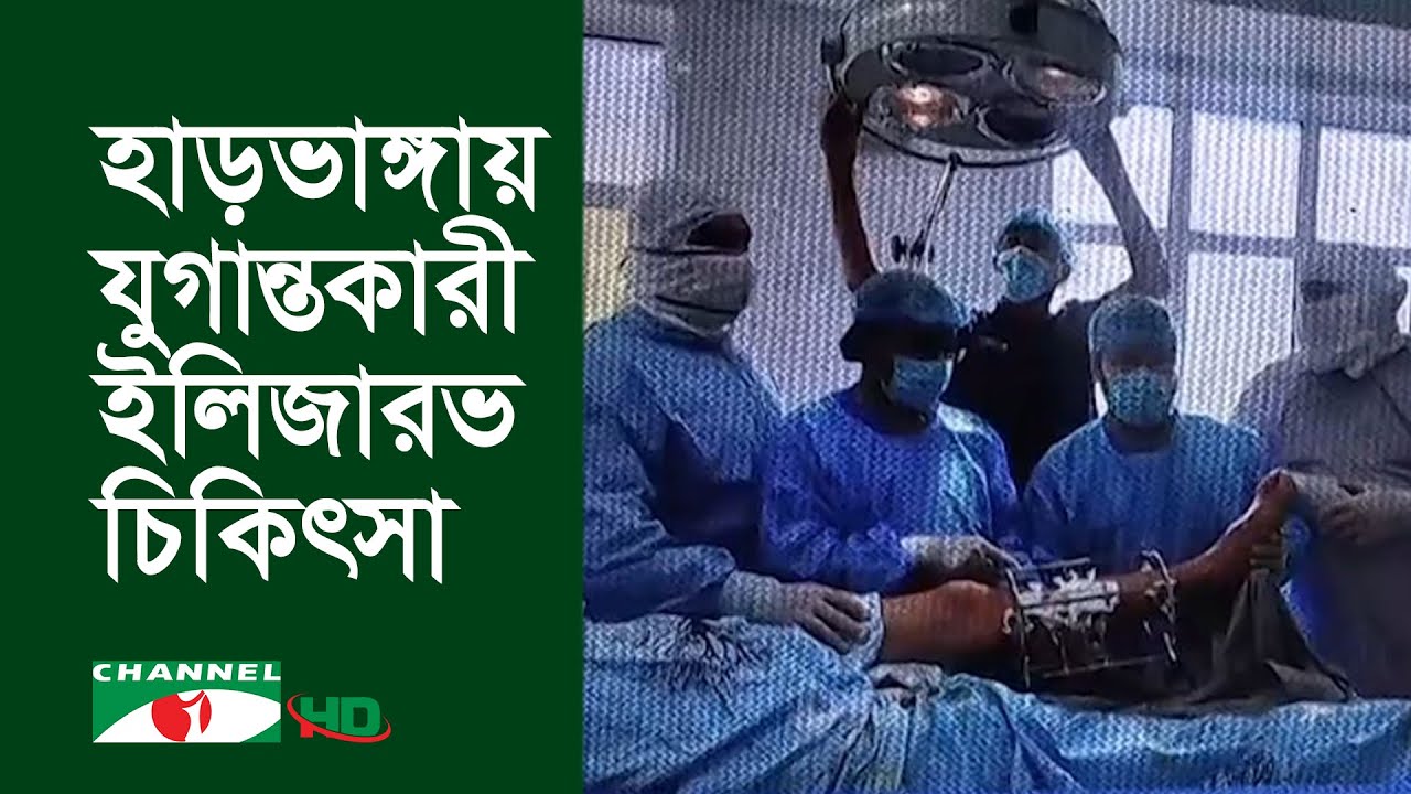হাড়ভাঙ্গায় সব চিকিৎসা যেখানে ব্যর্থ ইলিজারভ চিকিৎসা সেখানে শুরু