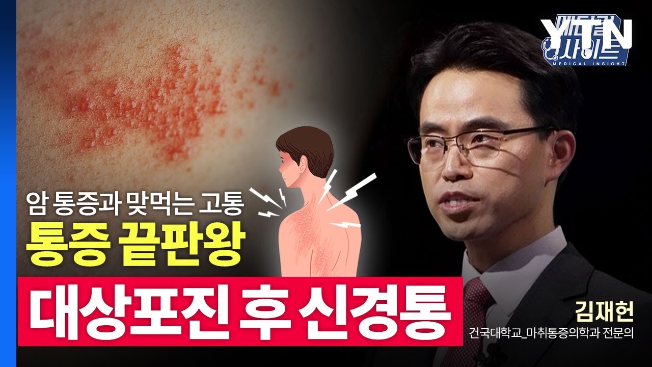 [메디컬 인사이트 33회] 마취통증의학과 전문의가 전하는 '대상포진 후 신경통의 모든 것' / YTN