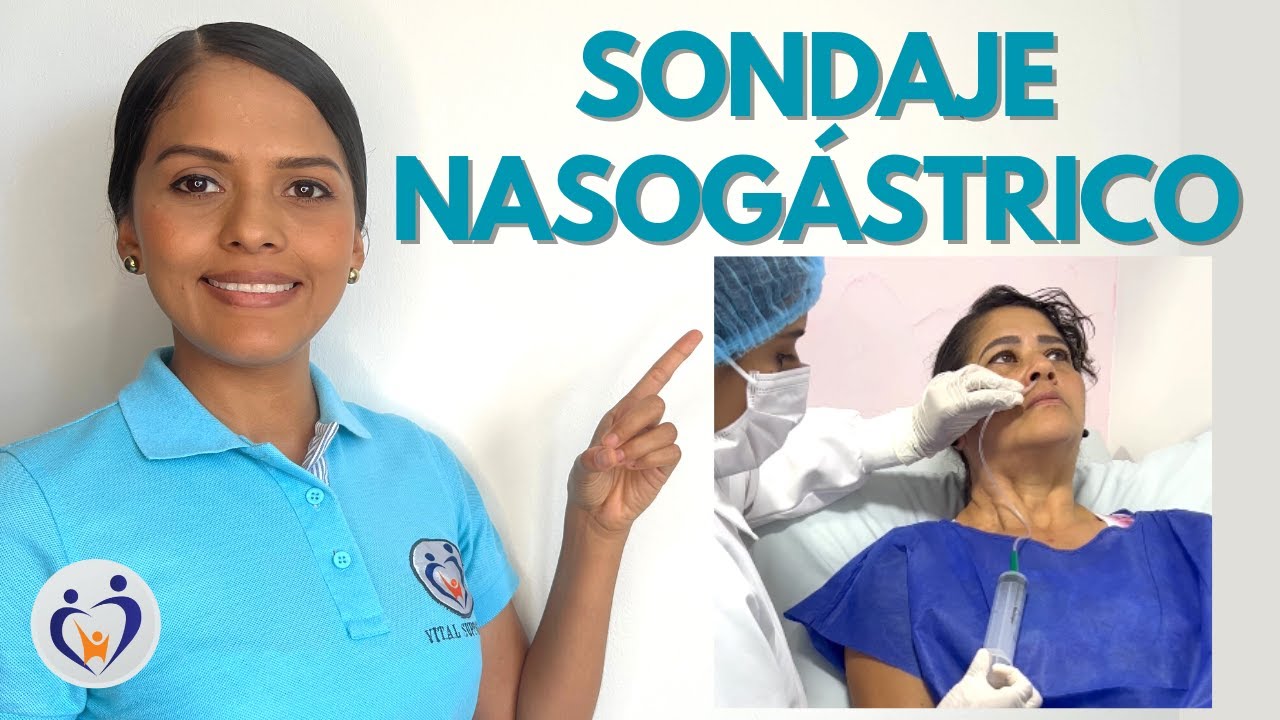 ¿CÓMO COLOCAR UNA SONDA NASOGÁSTRICA?