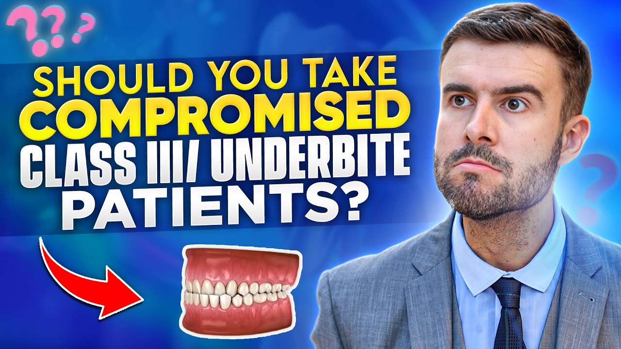 Should you Take Compromised Class III/ Underbite Patients?