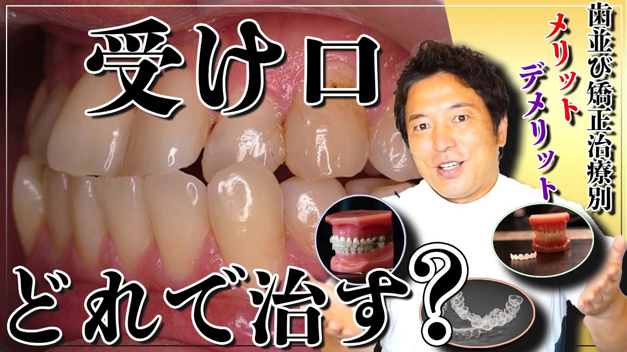あなたに適した受け口の治療は？？【歯並び’矯正治療別のメリット／デメリット】