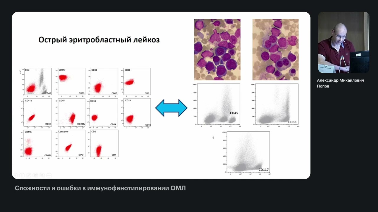 Сложности и ошибки в иммунофенотипировании ОМЛ