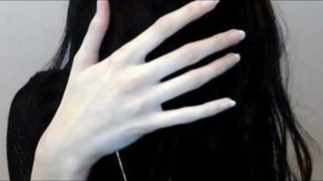 why ur skin is so pale?