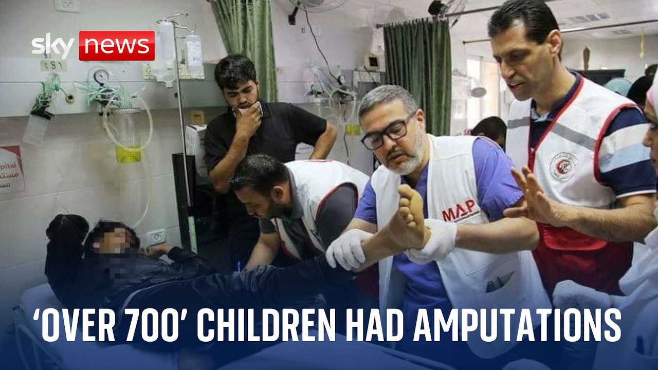 Gaza surgeon: At least 700 children had amputations | Israel-Hamas war
