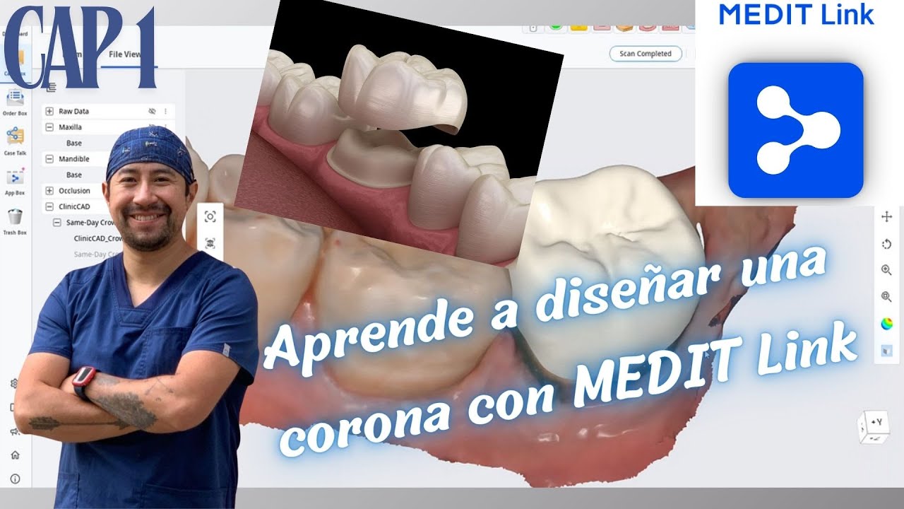 1. APRENDE A DISEÑAR UNA CORONA CON MEDIT LINK
