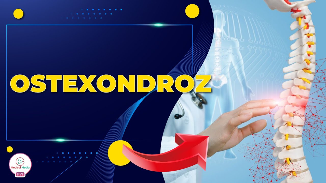 BOYUN AĞRILARI / OSTEXONDROZ / ÇİYİN AĞRILARININ SƏBƏBLƏRİ